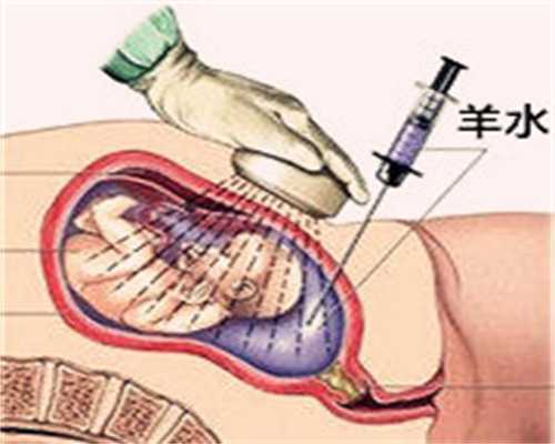香港验血结果网站查询,男的备孕时能拍ct么