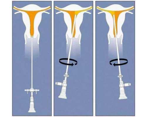 香港验血生男女准不准_“发明家”这个词的英语怎说？发明家英语单词怎么写