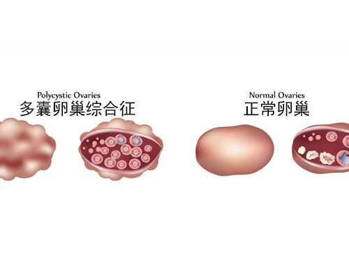 一体化提升泵站是如何施工的_保利香港推陈文希