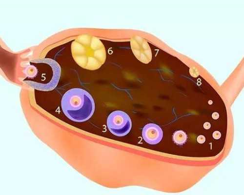 激光种子源和泵浦源区别_艺术品 评估中的 风险问题