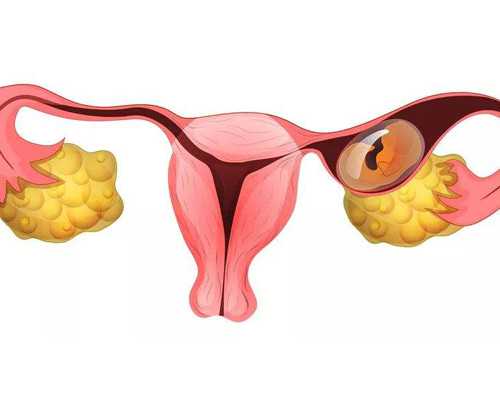 空气源热泵原理图_男士腹部燃脂运动让你的腹肌显露出来