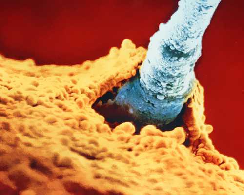 香港验血3次无结果_去香港哪里验血好_查性别准不准我为你解惑