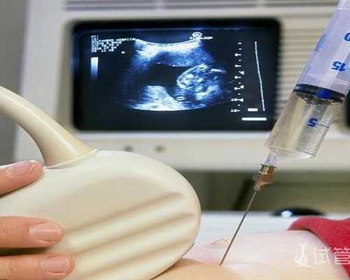 香港验血结果和b超一致_去香港验血验男女大概多少钱呢?？亲身经历告诉你真相