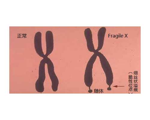 双胞胎香港可以验血看性别吗_香港验血胚芽末满2mm准吗_邮寄验血查男女准不准