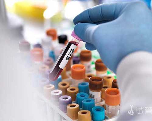 二次香港验血结果不同_香港验血检测规范条件是什么?香港诊所的陈小姐共享