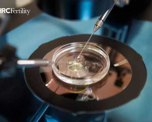 氨茶碱静脉泵剂量和用法_文博考古圈子里的情怀能挣多少钱