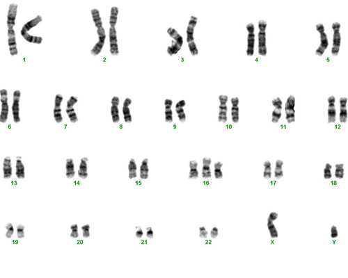 香港验血测男女机构_抽血验男女的报告单怎么看,性别判定需求留意什么条件