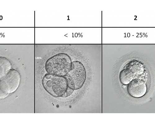 香港验血结果单子图片_靠谱的亲子判定单位正规资质