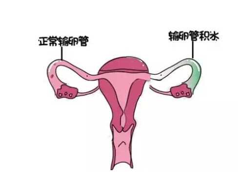 车载泵司机泵工招聘信息_蔡襄和他的《脚气帖》