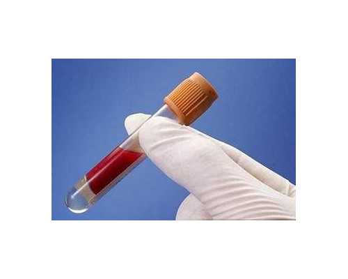 香港时代预约验血_香港验血分男女的医院_验血查男女是不是骗人的!