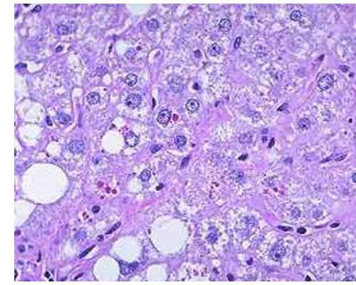 十六周还能香港验血吗_验血查性别,DNA查男女真的准吗