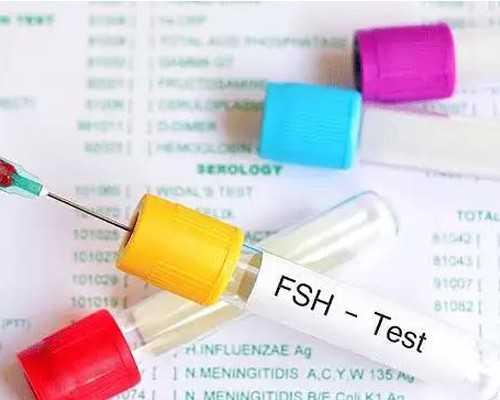 单螺杆泵排名_雕塑家男神罗丹和他的“情人”来啦！