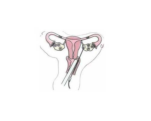 家用增压本泵调压_肉沫豆腐蛋羹—懒人家常菜