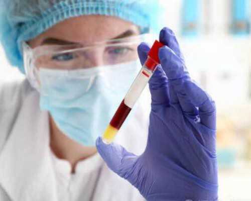 香港验血7周早吗_香港化验所公司_查男女需要准备什么材料