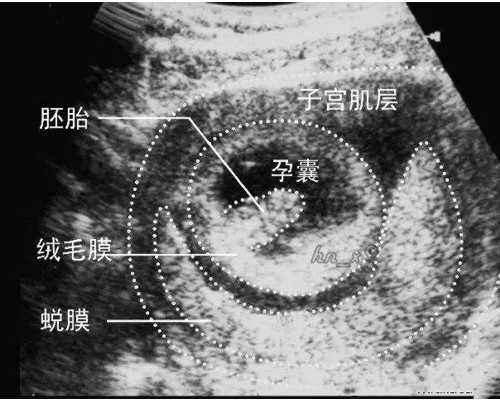 香港验血准确率大吗_香港验血多久知道男女_验血查男女选择哪家!