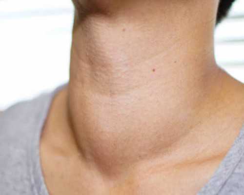 香港邮寄验血靠谱吗_香港验血查性别mk诊所_你想知道的流程都在这!