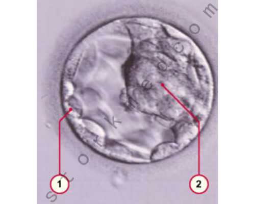 香港诊所验血查男女_香港验血报告会出现一个D的情况么_检测性别需要带些什么