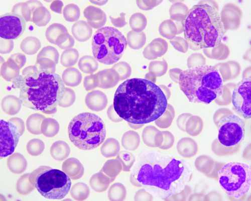 香港验血快递血坏不了吗_香港验血怎样比较方便_邮寄验血准不准!