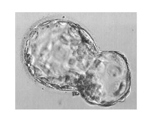 香港有验血雅达高官网_分享我去香港验血查宝宝性别的真实经历