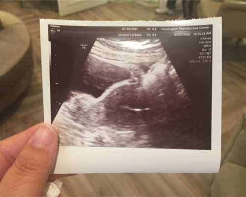 水族潜水泵使用图解_屁股上的肉怎么减