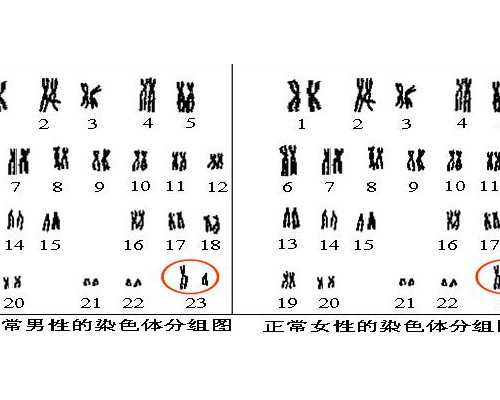 液压泵的类型_11个窍门让你瘦瘦瘦