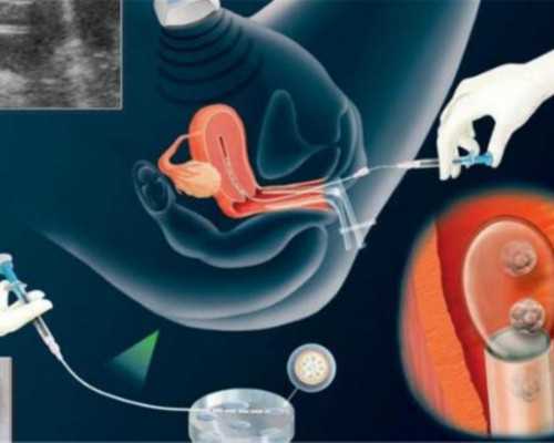 香港验血太早会准确吗_香港验血15项分别代表什么_性别鉴定真的有那么高准确