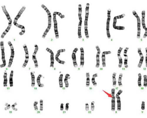 香港玛西实验室验血准确吗_寄血香港验血会影响准确吗_查生男女准确率有多高