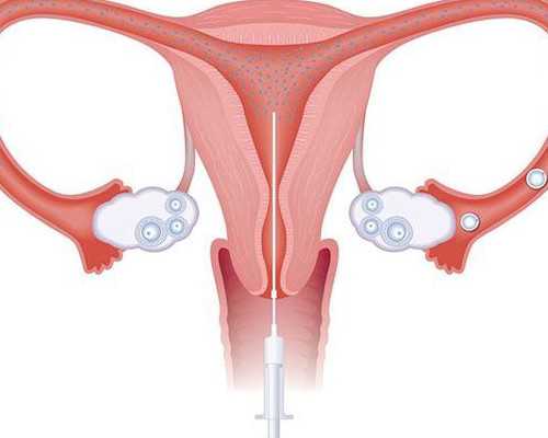 香港验血当天有结果吗_香港程立志妇产科验血_几周检测性别最准确