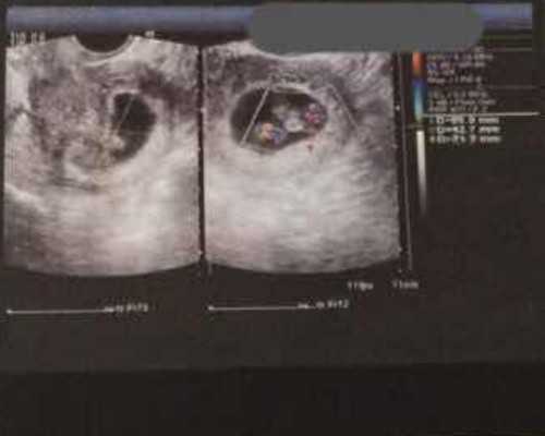 离心泵的分类及用途_文化和旅游部推动落实传统工艺高质量传承发展