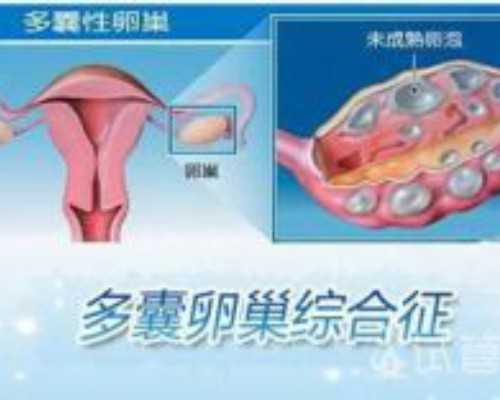 香港验血中介联系_45天香港验血会出错吗_性别鉴定详细流程说明