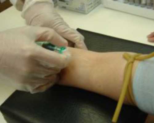 香港验血几周比较好_香港旺角验血_查性别需要什么条件!