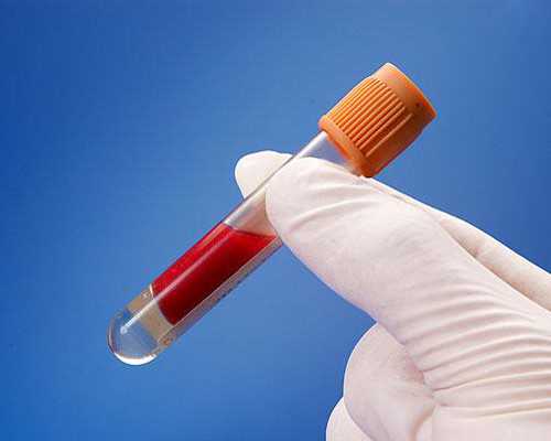 地贫会影响香港验血结果_“800px800px的图片”是啥意思?用ps如何把图片弄成8