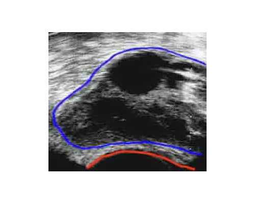 往复泵设计手册_属龙的狮子座男生性格