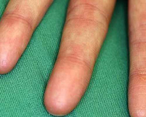 香港验血男宝女宝准不准_怀孕香港验血知道男女准吗_验血和B超都是男孩会翻盘