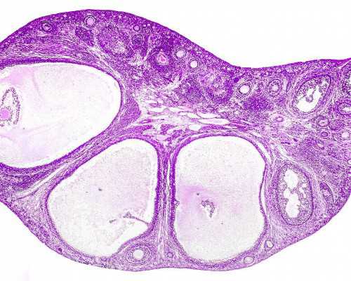 去香港验血怎么看结果单_香港验血85_验血是女孩_能翻盘么