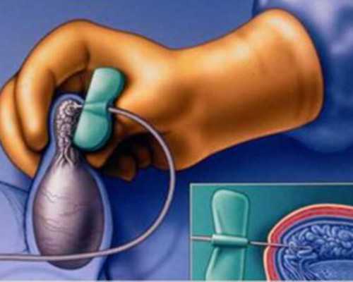 有没有香港邮寄验血被骗的_关于香港验血查男女准不准_看看生过的宝妈怎么说