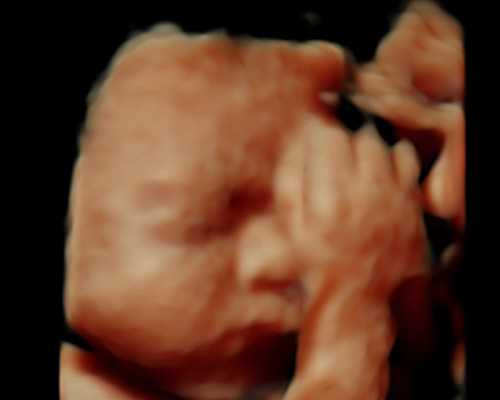 香港化验血查男女最准确机构_香港验血女请求翻盘_dna胎儿详细流程是什么!