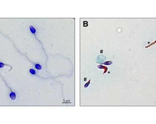 香港验血邮寄需要冰袋吗_元宵节资料有什么关于元宵节的资料