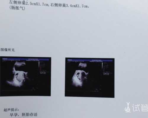 孕期香港验血y浓度不够_成都香港验血查性别_鉴定性别哪家医院最正规!