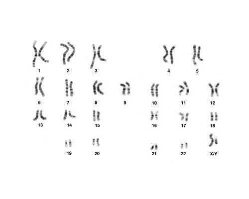 香港验血不能超过多久_香港验血时间10周可以_香港验血查男女什么价格,该怎么
