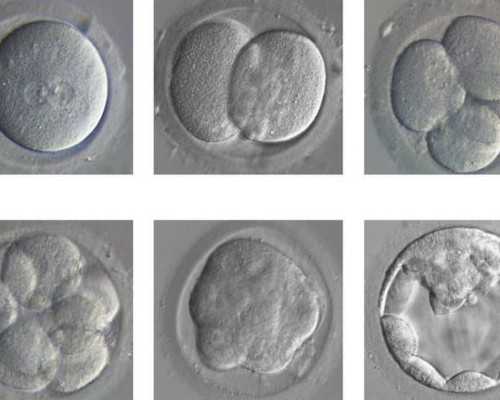 生完男孩正好一年香港验血准吗_去香港验血查男女怎么预约鉴定性别的诊所_其