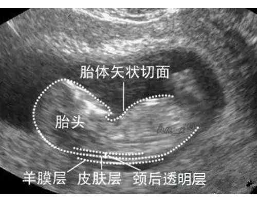 香港验血鉴定男女几周可以_香港验血DNA需求满意哪些条件才干知道宝宝是男孩