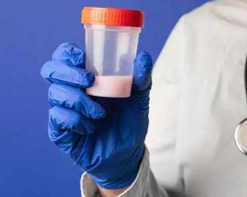 去香港验血最晚多少天比较准_香港验血3500元_验血查性别真的准吗