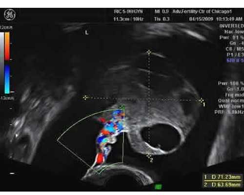 香港验血寄过去靠谱吗_靠谱的查男女组织老品牌牢靠