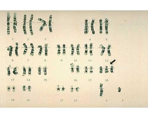 香港验血测性别有误差吗_香港验血机构要谨慎选择,香港正规权威化验所