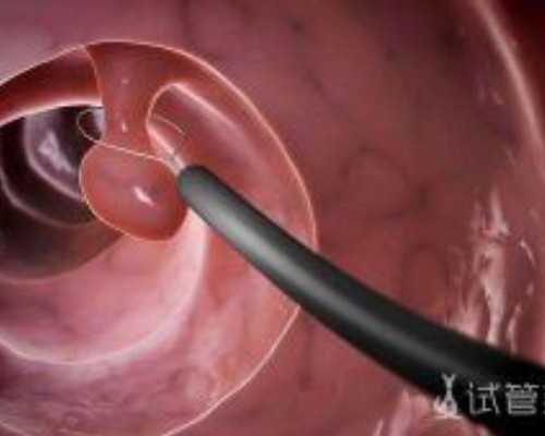 香港验血七周可以吃早餐_内地孕妈怎么预定去香港查血验男女