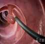 香港验血七周可以吃早餐_内地孕妈怎么预定去香港查血验男女