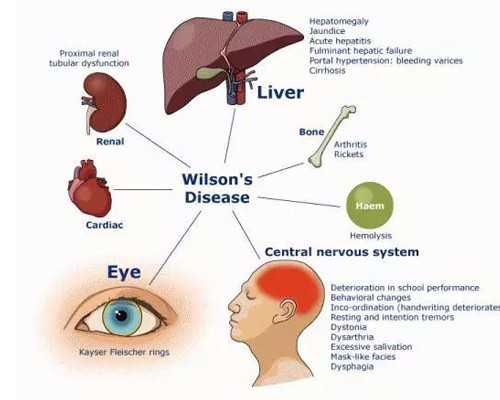 暖气循环泵改为自来水增压泵_国博举办甲骨文金文集萃展