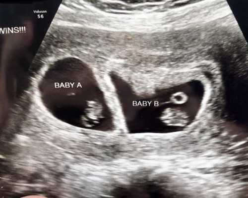 香港邮寄验血被骗3800_怎么预约香港验血医院_总结了下个人经验跟大家分享下