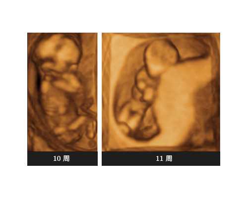 早孕去香港验血看男女准吗_香港验血要多少天_邮寄验血准不准